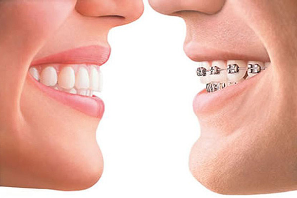 Orthodontics, Advanced Dental Care, Kathmandu, Nepal